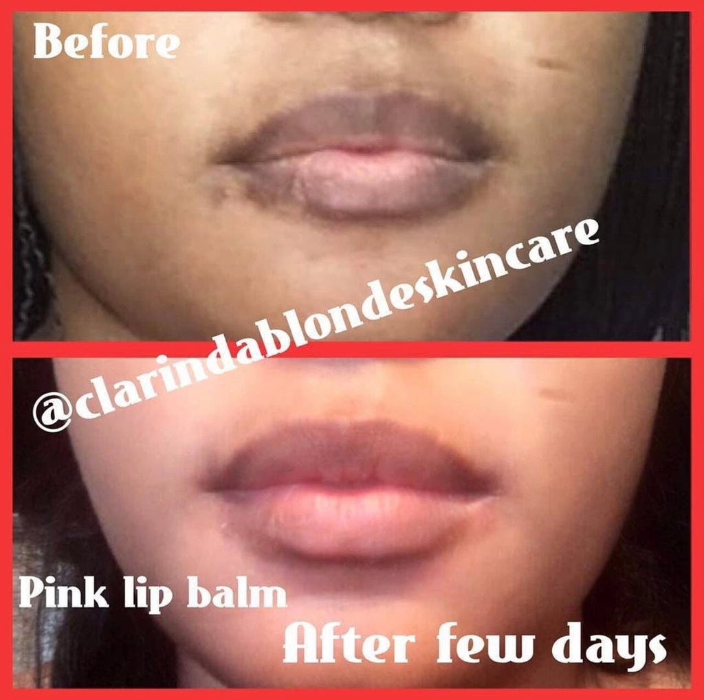 Pink Lips Magic Skin Care Clarinda Blonde 