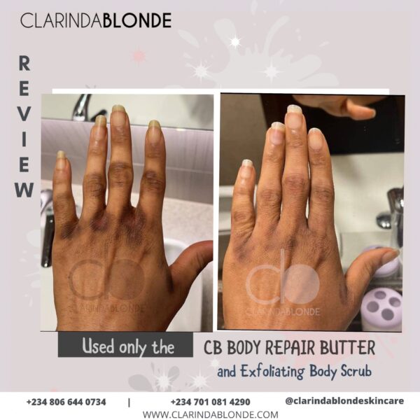 BODY REPAIR BUTTER Skin Care Clarinda Blonde