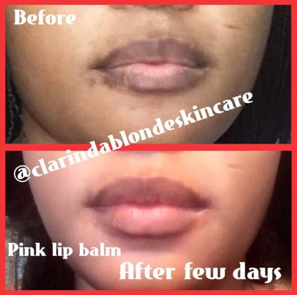 Pink Lips Magic Skin Care Clarinda Blonde