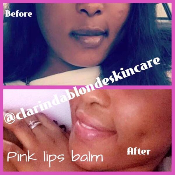 Pink Lips Magic Skin Care Clarinda Blonde