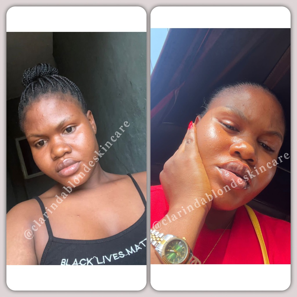 Clarinda Blonde Skincare natural skin glow transformation before and after