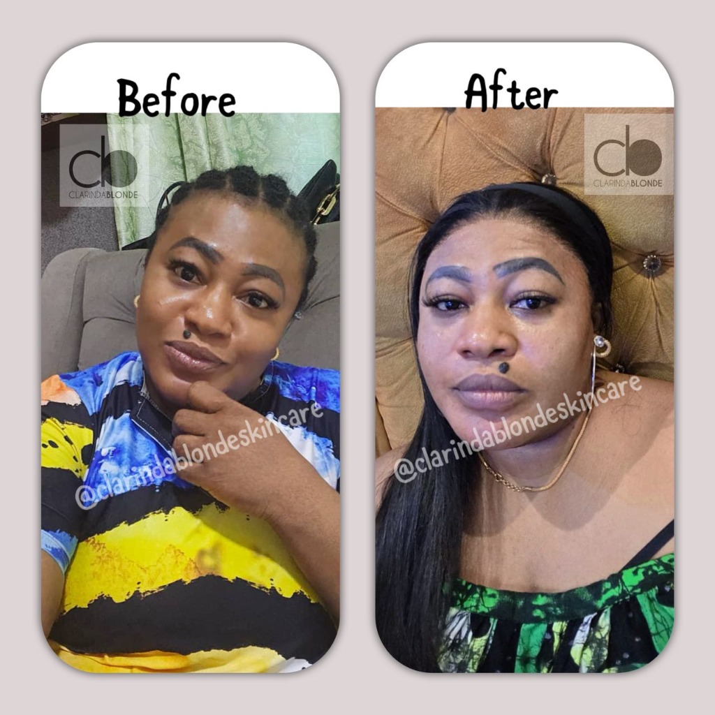 Clarinda Blonde Skincare skin glow transformation before and after