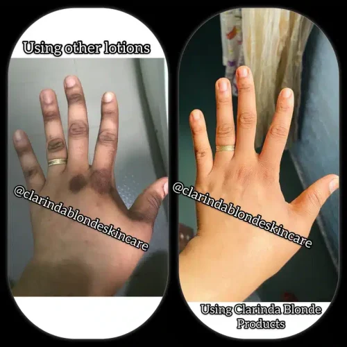 how-to-get-rid-of-dark-knuckles-fast-and-permanently-249542_800x